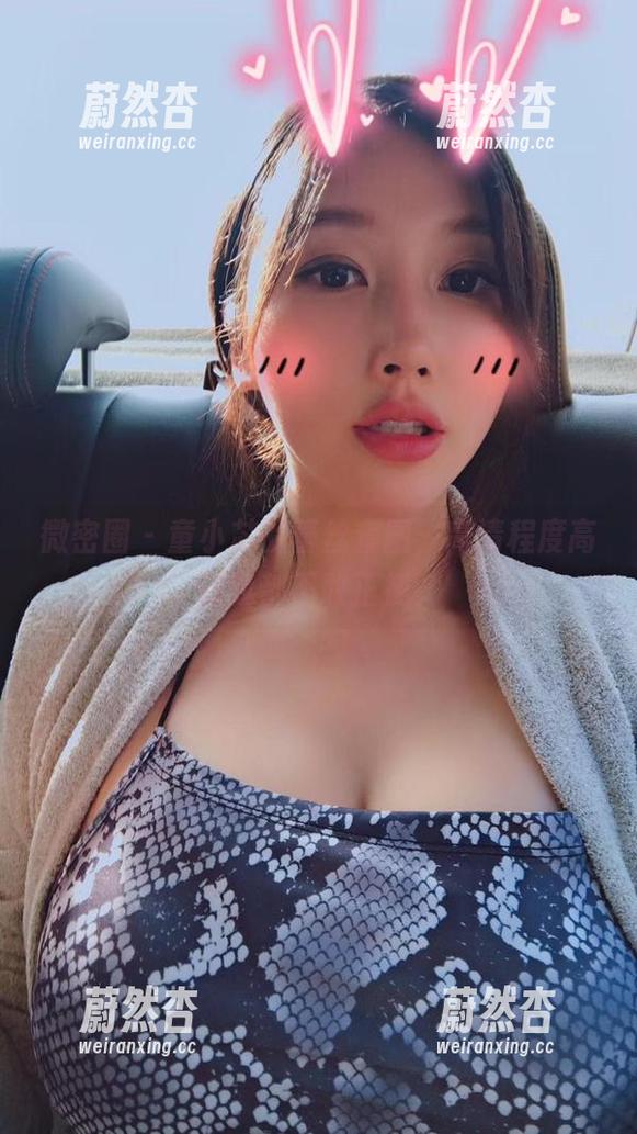微密圈 - 童小芯的蕾丝套图，高清程度高到我都不敢正视。